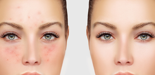 Photo showing before and after clear skin package